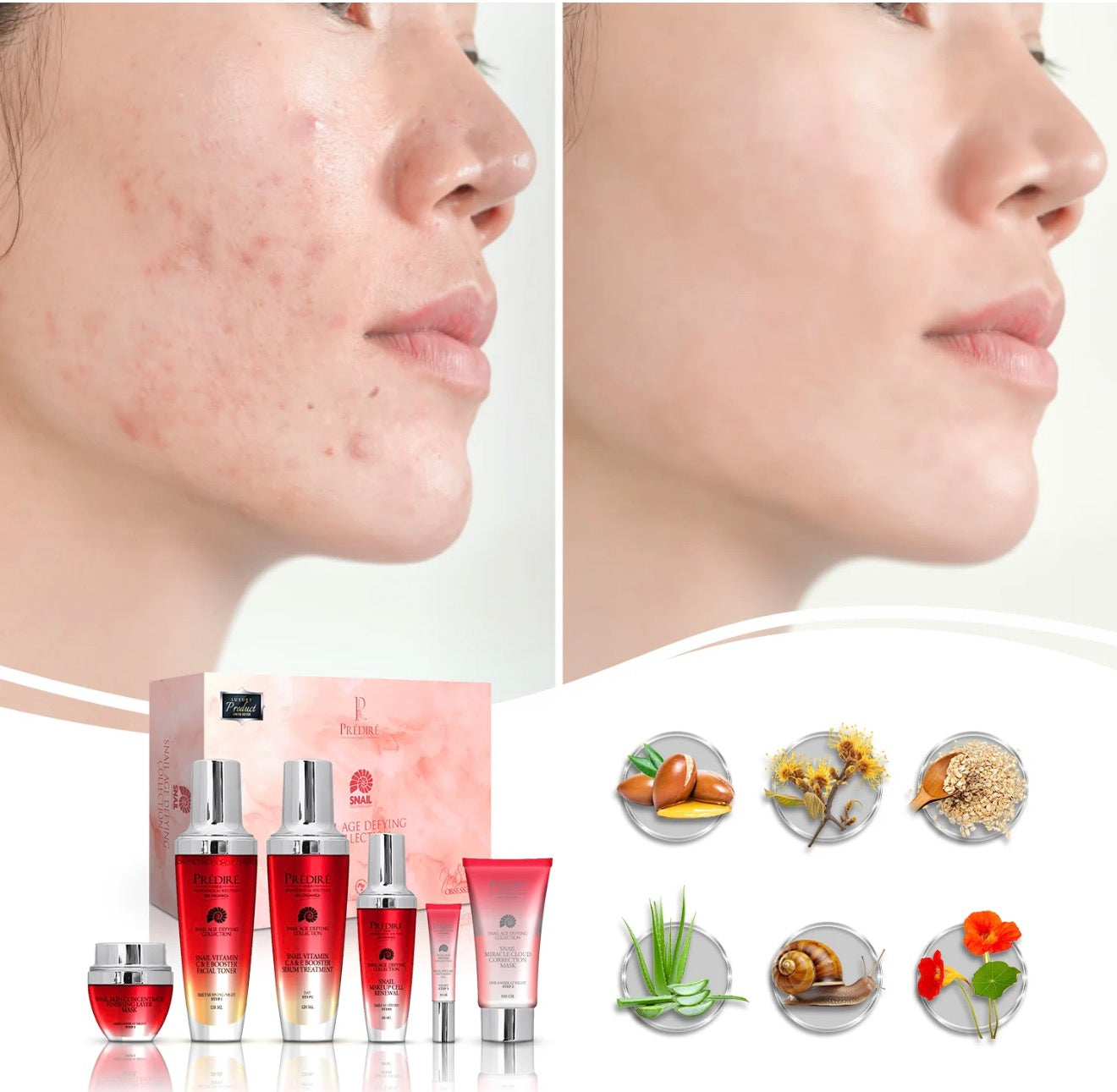 Everyday Care Finishing Layer Mask with Wrinkle Vanisher Device | 3-In-1 with LED Treatment, Massager for Blood Circulation, & Wrinkle Eraser