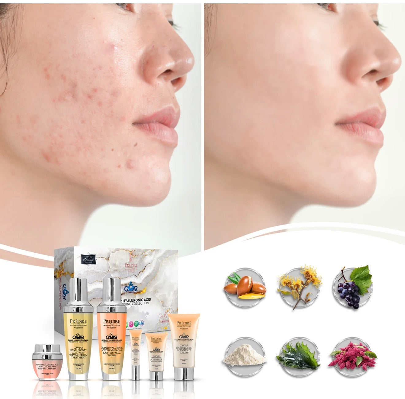 PREDIRE PARIS
Caviar Hyaluronic Acid Age-Defying Collection | Renew, Moisturize, Cream, Serum, Mask & Toner | Limited Edition